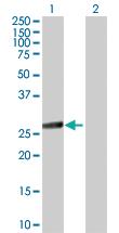 Anti-IKBKB Mouse Polyclonal Antibody