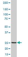 Anti-RPIA Mouse Polyclonal Antibody