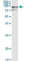 Anti-RBM5 Polyclonal Antibody Pair