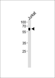 Anti-NR2C2 Rabbit Polyclonal Antibody (AP (Alkaline Phosphatase))