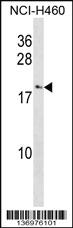 Anti-CCL27 Rabbit Polyclonal Antibody