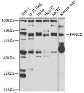 Anti-FANCG antibody