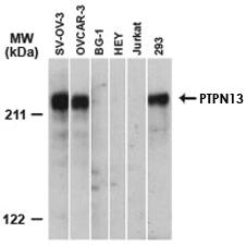 Anti-PTPN13 Rabbit Polyclonal Antibody