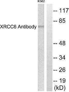 Western blot analysis of lysates from K562 cells using Anti-XRCC6 Antibody. The right hand lane represents a negative control, where the antibody is blocked by the immunising peptide