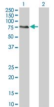 Anti-MGRN1 Mouse Monoclonal Antibody [clone: 3E1]