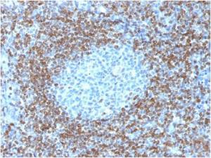 Immunohistochemical analysis of formalin-fixed, paraffin-embedded human tonsil using Anti-Bcl-2 Antibody [BCL2/1878R]