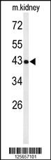 Anti-UBXN6 Rabbit Polyclonal Antibody