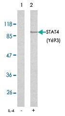 Anti-STAT4 Rabbit Polyclonal Antibody