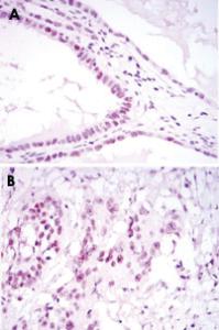 Anti-SUZ12 Mouse Monoclonal Antibody [clone: 3D10]