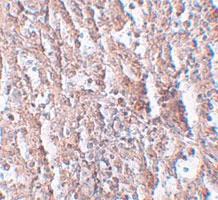 Anti-SLC39A5 Rabbit Polyclonal Antibody