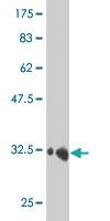 Anti-HEY1 Mouse Monoclonal Antibody [clone: 3B3]