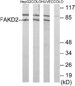 Western blot analysis of lysates from HUVEC, HepG and COLO cells using Anti-FAKD2 Antibody. The right hand lane represents a negative control, where the antibody is blocked by the immunising peptide