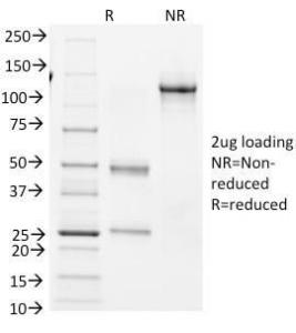 SDS-PAGE analysis of Anti-Bcl-6 Antibody [BCL6/1982] under non-reduced and reduced conditions; showing intact IgG and intact heavy and light chains, respectively. SDS-PAGE analysis confirms the integrity and purity of the antibody