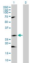 Anti-IKBKB Rabbit Polyclonal Antibody