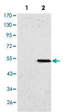 Anti-SUZ12 Mouse Monoclonal Antibody [clone: 3D10]