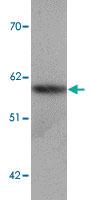 Anti-SLC39A5 Rabbit Polyclonal Antibody