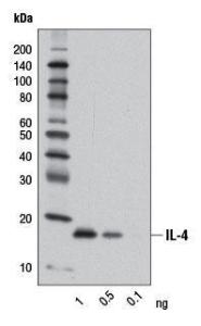 Anti-IL4 Rabbit Monoclonal Antibody [clone: 13G40]