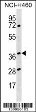 Anti-HNRNPH3 Rabbit Polyclonal Antibody