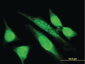 Anti-MGRN1 Mouse Monoclonal Antibody [clone: 3E1]