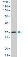 Anti-RPIA Mouse Polyclonal Antibody