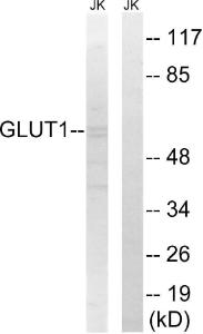 Western blot analysis of lysates from Jurkat cells using Anti-GLUT1 Antibody. The right hand lane represents a negative control, where the Antibody is blocked by the immunising peptide