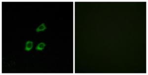 Immunofluorescence analysis of HUVEC cells using Anti-CLCN4 Antibody The right hand panel represents a negative control, where the antibody was pre-incubated with the immunising peptide