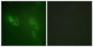 Immunofluorescence analysis of NIH/3T3 cells using Anti-IR Antibody The right hand panel represents a negative control, where the antibody was pre-incubated with the immunising peptide