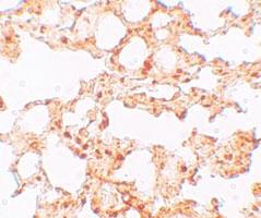 Anti-SLC39A6 Rabbit Polyclonal Antibody