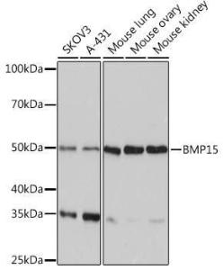 Western blot analysis of extracts of various cell lines, using Anti-BMP15 Antibody [ARC0907] (A306596) at 1:1,000 dilution