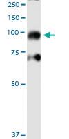 Anti-IKBKB Mouse Monoclonal Antibody [clone: 1A3]