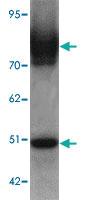 Anti-SLC39A6 Rabbit Polyclonal Antibody