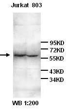 Anti-IL6R Rabbit Polyclonal Antibody