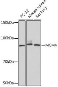 Western blot analysis of extracts of various cell lines, using Anti-MCM4 Antibody [ARC1491] (A306597) at 1:1,000 dilution