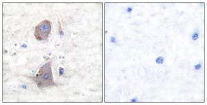 Immunohistochemical analysis of paraffin-embedded human brain tissue using Anti-GLUT1 Antibody. The right hand panel represents a negative control, where the Antibody was pre-incubated with the immunising peptide