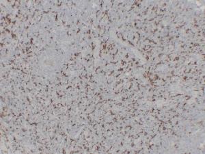 Immunohistochemical analysis of paraffin-embedded human Tonsil using Anti-CD163 Antibody