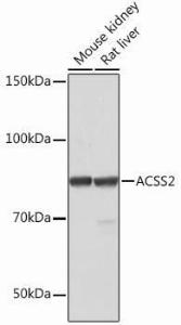 Western blot analysis of extracts of various cell lines, using Anti-ACSS2 Antibody [ARC0690] (A306598) at 1:1,000 dilution. The secondary antibody was Goat Anti-Rabbit IgG H&L Antibody (HRP) at 1:10,000 dilution.