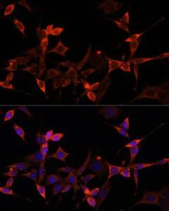 Antibody anti-AKT1S1 100 µl