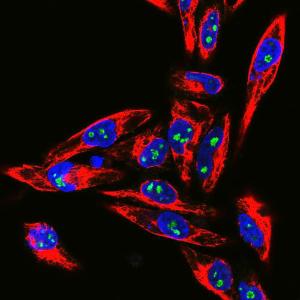 Confocal immunofluorescent analysis of HeLa cells stained with Anti-Fibrillarin Antibody (1:10,000 / green) and Anti-Vimentin Antibody (A85424 / 1:1,000 / red). The blue signal is DAPI staining of nuclear DNA.