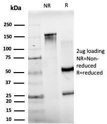 SDS-PAGE analysis of Anti-JunB Antibody [PCRP-JUNB-3G11] under non-reduced and reduced conditions; showing intact IgG and intact heavy and light chains, respectively. SDS-PAGE analysis confirms the integrity and purity of the antibody