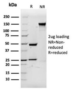 SDS-PAGE analysis of Anti-CD3 epsilon Antibody [rC3e/1931] under non-reduced and reduced conditions; showing intact IgG and intact heavy and light chains, respectively. SDS-PAGE analysis confirms the integrity and purity of the Antibody