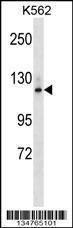 Anti-EPHA7 Rabbit Polyclonal Antibody (AP (Alkaline Phosphatase))