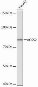 Western blot analysis of extracts of HepG2 cells, using Anti-ACSS2 Antibody [ARC0690] (A306598) at 1:1,000 dilution. The secondary antibody was Goat Anti-Rabbit IgG H&L Antibody (HRP) at 1:10,000 dilution.