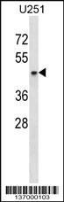 Anti-SH3GL1 Rabbit Polyclonal Antibody