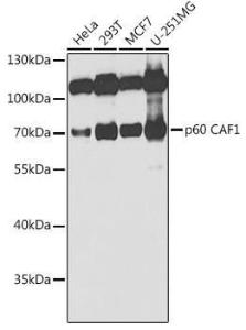 Western blot analysis of extracts of various cell lines, using Anti-p60 CAF1/MPP7 Antibody (A11945) at 1:1,000 dilution The secondary antibody was Goat Anti-Rabbit IgG H&L Antibody (HRP) at 1:10,000 dilution Lysates/proteins were present at 25 µg per lane