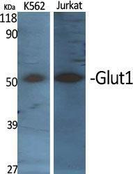 Western blot analysis of various cells using Anti-GLUT1 Antibody