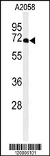 Anti-XRCC6 Rabbit Polyclonal Antibody