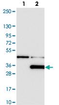 Anti-LYPLAL1 Rabbit Polyclonal Antibody