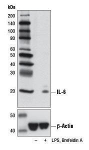 Anti-Interleukin 6 Rabbit Monoclonal Antibody [clone: 13G41]