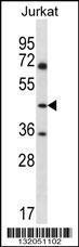 Anti-ASS1 Rabbit Polyclonal Antibody (HRP (Horseradish Peroxidase))