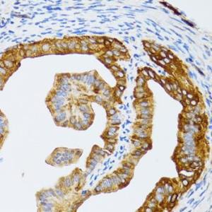 Immunohistochemistry analysis of paraffin-embedded rat fallopian tube using Anti-p60 CAF1/MPP7 Antibody (A11945) at a dilution of 1:100 (40x lens) Perform microwave antigen retrieval with 10 mM PBS buffer pH 72 before commencing with IHC staining protocol